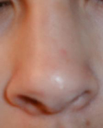 image of a nose