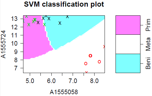 Radial SVM classification plot